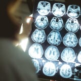 alzheimer decouverte scientifique japon