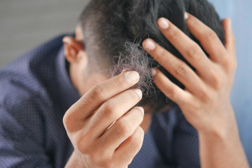 Des patients atteints de perte de cheveux sévère ont retrouvé jusqu’à 100 % de leur pilosité grâce à un médicament déjà utilisé contre d’autres maladies